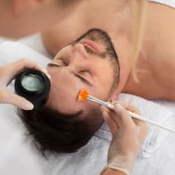 Acne Control Facial